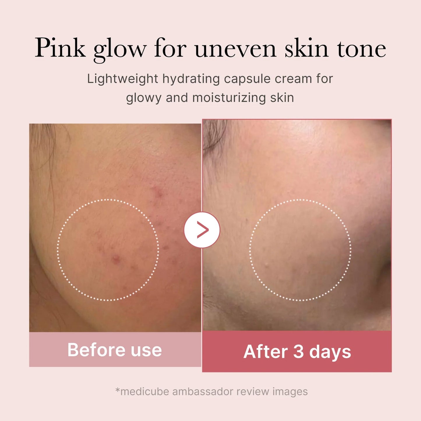 Crème en capsules de collagène rose PDRN