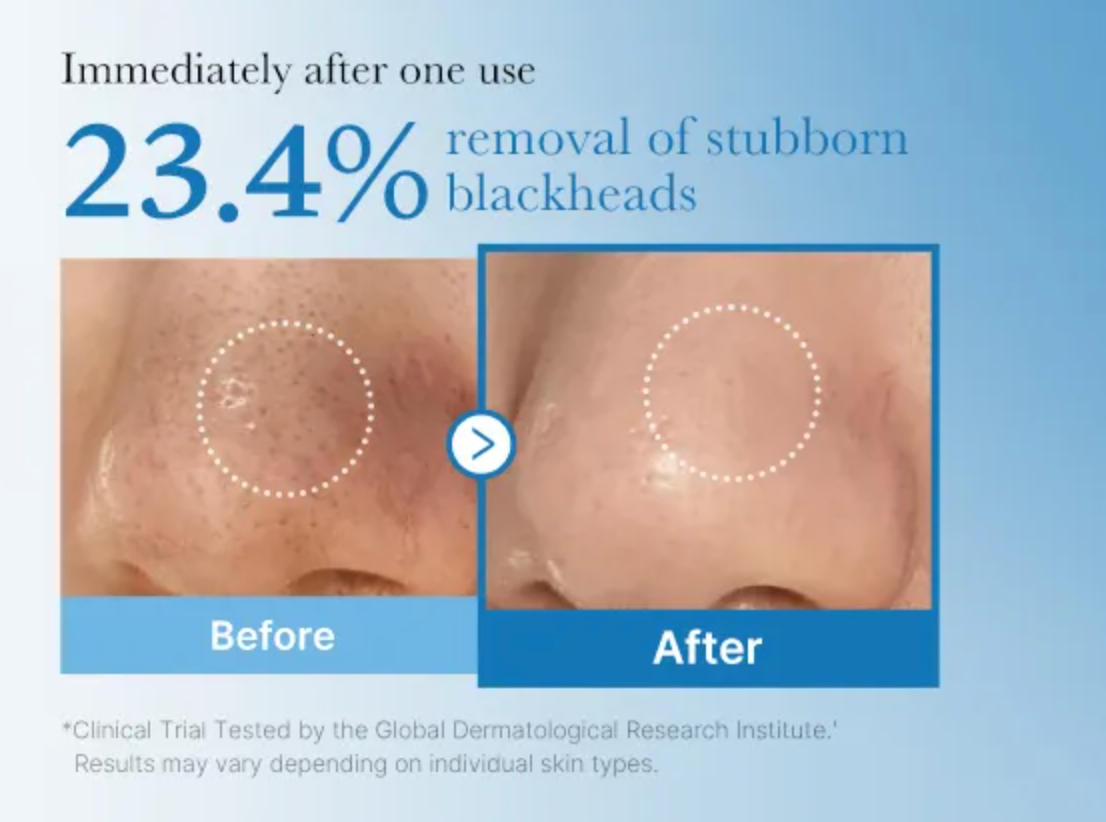 Zero Pore Blackhead Deep Cleansing Oil