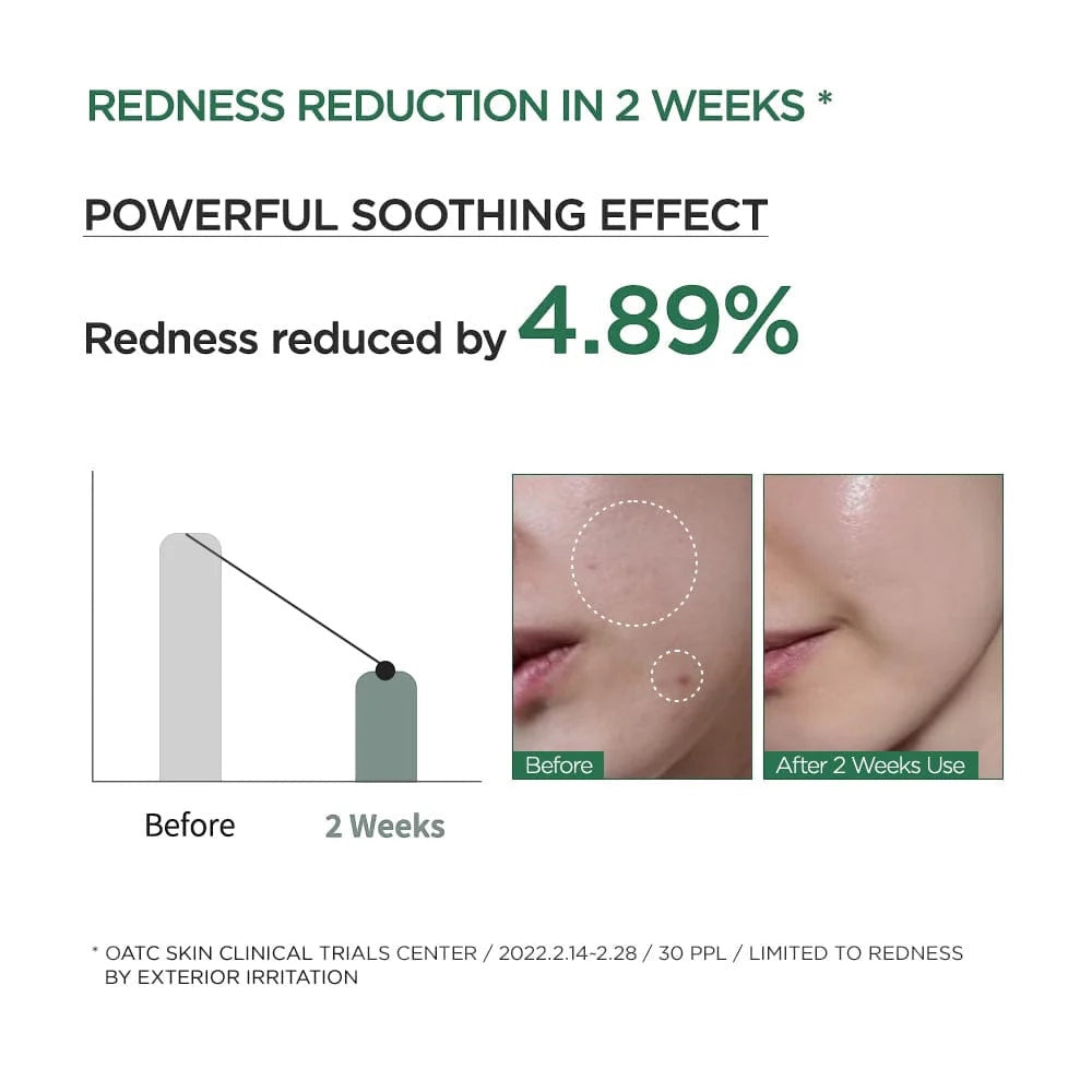 Anua Heartleaf 80% Vocht Verzachtende Ampoule