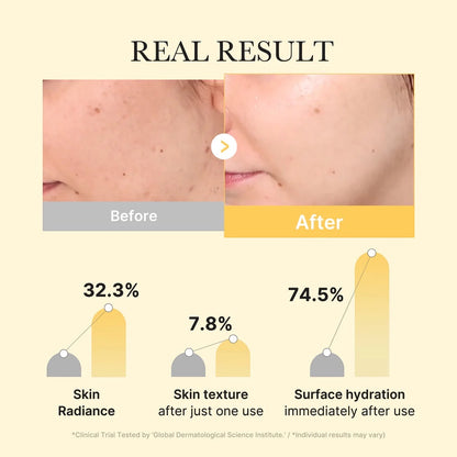Kojic Acid Turmeric Gold Jelly Gel Mask