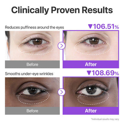 No.9 NAD+ Collagen Under Eye Patches (5 Pairs).