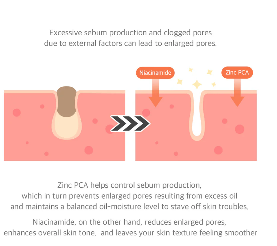 15% Niacinamide Zuiverheidsserum