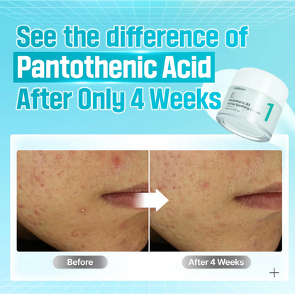 No.1 Pantothenic B5 Active Soothing Cream